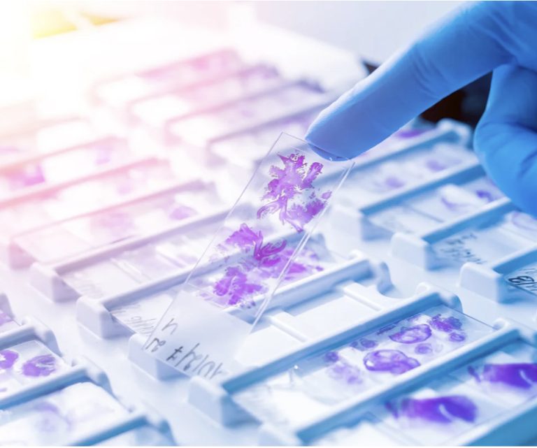 Motion Control From Alio Industries Optimises Accuracy Of Digital Pathology Instruments